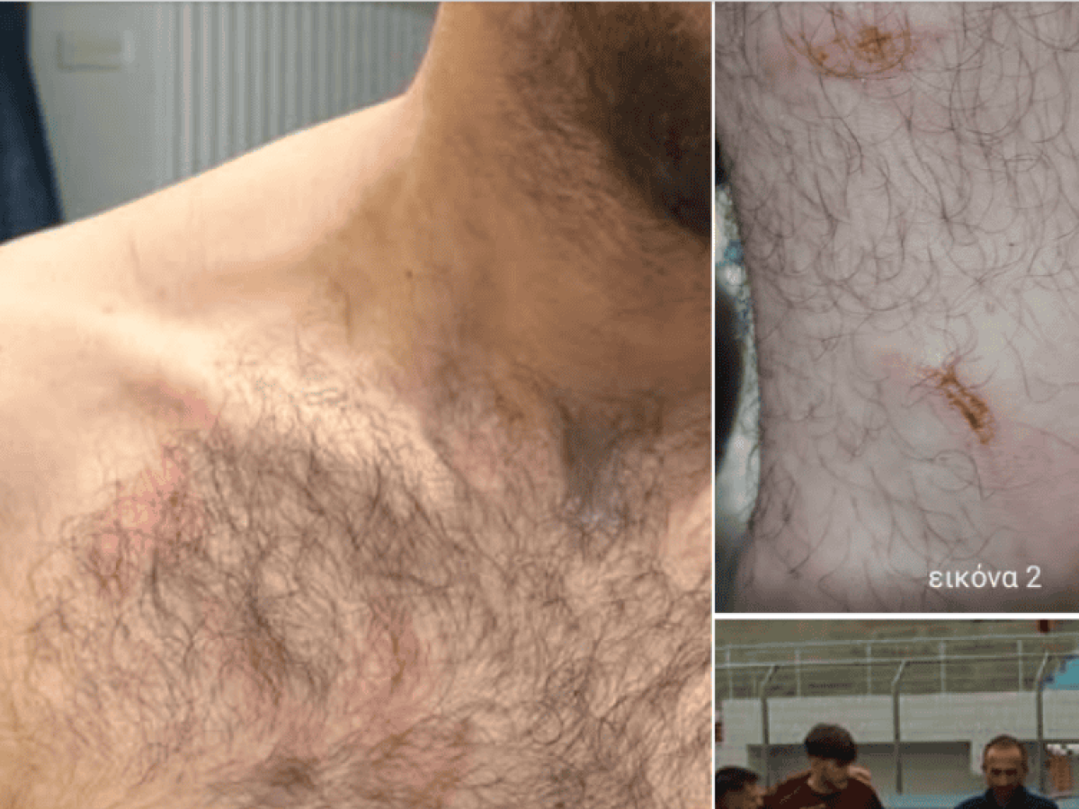 «Ντράπηκε και η ντροπή» – Σφοδρά παράπονα από τον Κιλκισιακό για τη διαιτησία – Δείτε εικό