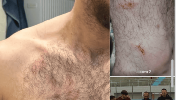 &laquo;&Nu;&tau;&rho;ά&pi;&eta;&kappa;&epsilon; &kappa;&alpha;&iota; &eta; &nu;&tau;&rho;&omicron;&pi;ή&raquo; &ndash; &Sigma;&phi;&omicron;&delta;&rho;ά &pi;&alpha;&rho;ά&pi;&omicron;&nu;&alpha; &alpha;&pi;ό &tau;&omicron;&nu; &Kappa;&iota;&lambda;&kappa;&iota;&sigma;&iota;&alpha;&kappa;ό &gamma;&iota;&alpha; &tau;&eta; &delta;&iota;&alpha;&iota;&tau;&eta;&sigma;ί&alpha; &ndash; &Delta;&epsilon;ί&tau;&epsilon; &epsilon;&iota;&kappa;ό